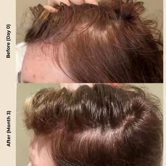 Hair2